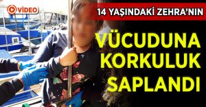 Vücuduna teknenin korkuluğu saplanan 14 yaşındaki çocuk ağır yaralandı