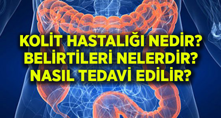 Kolit Hastalığı nedir? Kolit